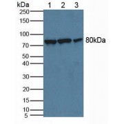 Western blot analysis of (1) Human HeLa cells, (2) Human Lung Tissue and (3) Human 293T Cells.
