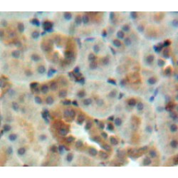 Early Endosome Antigen 1 (EEA1) Antibody
