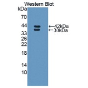 Western blot analysis of the recombinant protein.