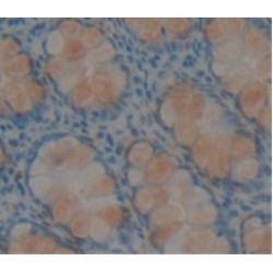 Resistin Like Beta (RETNLb) Antibody