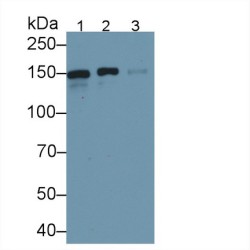 Endoplasmic Reticulum To Nucleus Signalling 1 (ERN1) Antibody