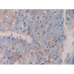 Tumor Necrosis Factor Receptor Superfamily Member 12A / TWEAKR (TNFRSF12A) Antibody