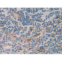 Tumor Necrosis Factor Receptor Superfamily Member 12A / TWEAKR (TNFRSF12A) Antibody