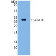 Western blot analysis of recombinant Human ADCY1.