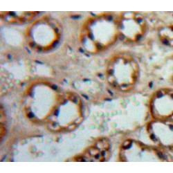 Adenylate Cyclase 1, Brain (ADCY1) Antibody