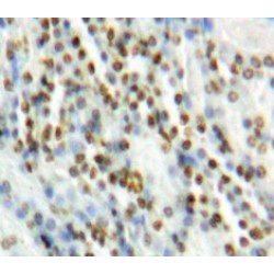 Mitogen-Activated Protein Kinase 7 / ERK5 (MAPK7) Antibody