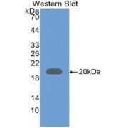 Western blot analysis of the recombinant protein.