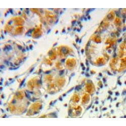 Frataxin (FXN) Antibody