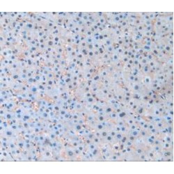 Pannexin 1 (PANX1) Antibody