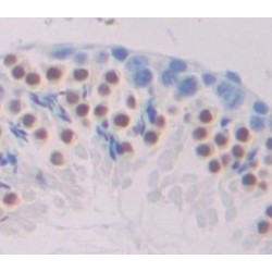 T-Box Transcription Factor TBX21 (TBX21) Antibody