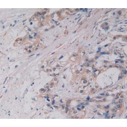 Macrophage Colony-Stimulating Factor 1 (CSF1) Antibody
