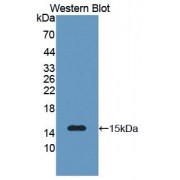 Western blot analysis of recombinant Human SAA2.