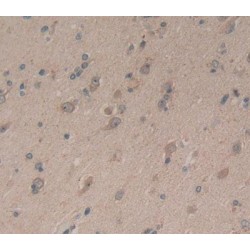 Neurocan (NCAN) Antibody