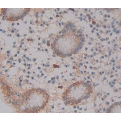 Glucosylceramide Transporter ABCA12 (ABCA12) Antibody