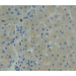 Sclerostin (SOST) Antibody