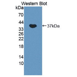 Ornithine Aminotransferase (OAT) Antibody