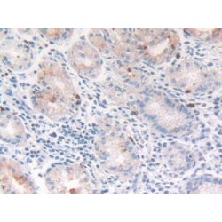 Cathepsin G (CTSG) Antibody