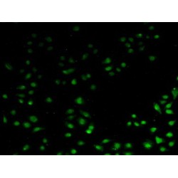 Apoptosis Inhibitor 5 (API5) Antibody