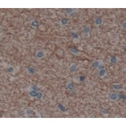 Interleukin 20 Receptor Alpha (IL20Ra) Antibody