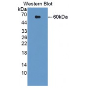Western blot analysis of recombinant Human USP14.