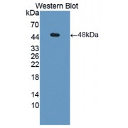 Western blot analysis of recombinant Human PGK1.