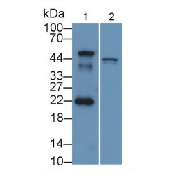 Mdm2 P53 Binding Protein Homolog (MDM2) Antibody