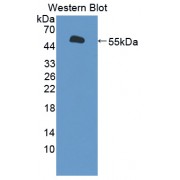 Western blot analysis of recombinant Human PLUNC.