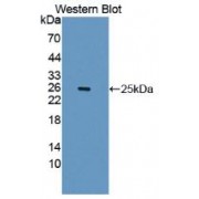 Western blot analysis of recombinant Human IL1RAPL1 Protein.