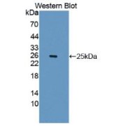 Western blot analysis of recombinant Human IL1RAPL1 Protein.