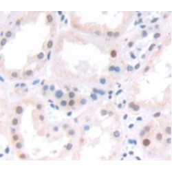 Activity Dependent Neuroprotector Protein (ADNP) Antibody