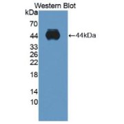 abx128117