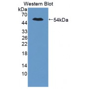 Western blot analysis of the recombinant protein.