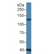 Western blot analysis of Pig Heart lysate, using Human ADAMTS19 Antibody (1 µg/ml) and HRP-conjugated Goat Anti-Rabbit antibody (<a href="https://www.abbexa.com/index.php?route=product/search&amp;search=abx400043" target="_blank">abx400043</a>, 0.2 µg/ml).