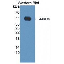 A Disintegrin And Metalloproteinase With Thrombospondin 19 (ADAMTS19) Antibody