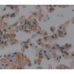 A Disintegrin And Metalloproteinase With Thrombospondin 19 (ADAMTS19) Antibody