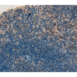 Cluster of Differentiation 226 (CD226) Antibody