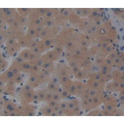 Complement Component 8g (C8g) Antibody