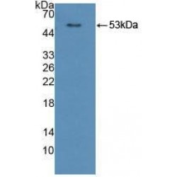Cytochrome P450 Oxidoreductase (POR) Antibody