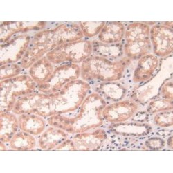 Cytochrome P450 Oxidoreductase (POR) Antibody