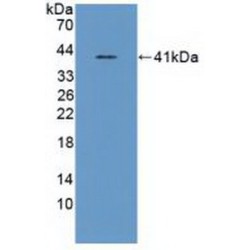 Asparagine Synthetase (ASNS) Antibody