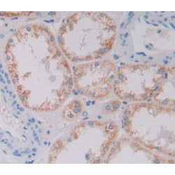 Dipeptidase 1, Renal (DPEP1) Antibody