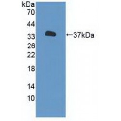 Purinergic Receptor P2X, Ligand Gated Ion Channel 7 (P2RX7) Antibody