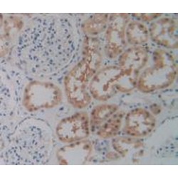Purinergic Receptor P2X, Ligand Gated Ion Channel 7 (P2RX7) Antibody