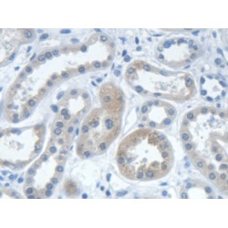 Isoleucyl tRNA Synthetase (IARS) Antibody