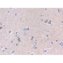 Neural Cell Adhesion Molecule 2 (NCAM2) Antibody