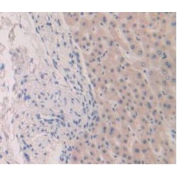 Fibroblast Growth Factor 19 (FGF19) Antibody