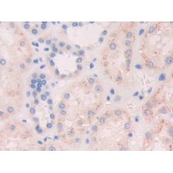 Fibroblast Growth Factor 19 (FGF19) Antibody