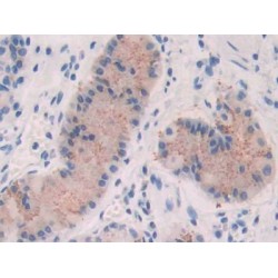 Fibroblast Growth Factor 19 (FGF19) Antibody