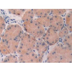 Fibroblast Growth Factor 19 (FGF19) Antibody