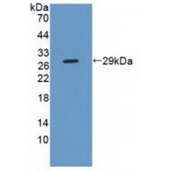 Phospholipase C Gamma 2, Phosphatidylinositol Specific (PLCg2) Antibody
